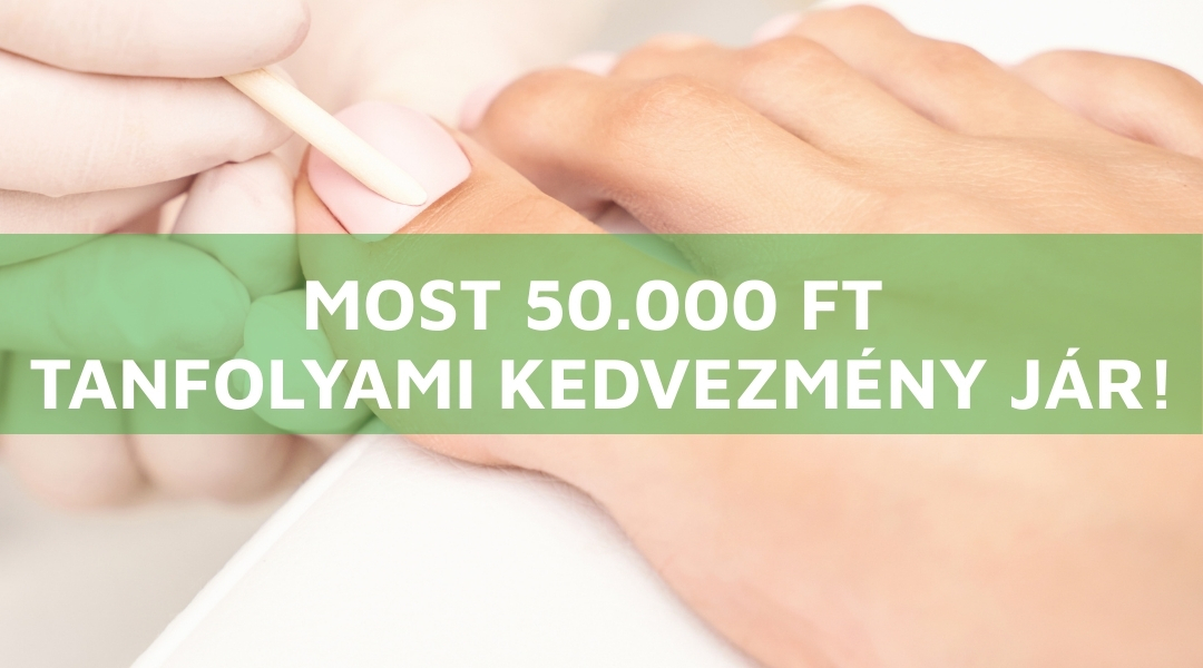 Kupon kép